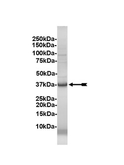 Eurofins DiscoverX RIPK2 Protein, Active 10 &mu;g | Buy Online | Eurofins DiscoverX | Fisher Scientific